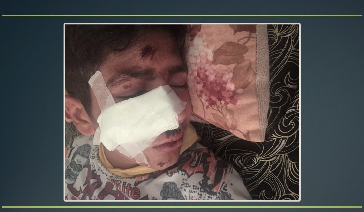 KHRN: Kurdish Border Porter Tortured by Iranian Border Guards at Nawsoud